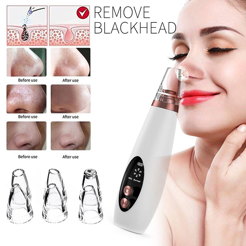 Blackhead Remover Vacuum | Pore Vacuum Cleaner | WhiteDiamonds